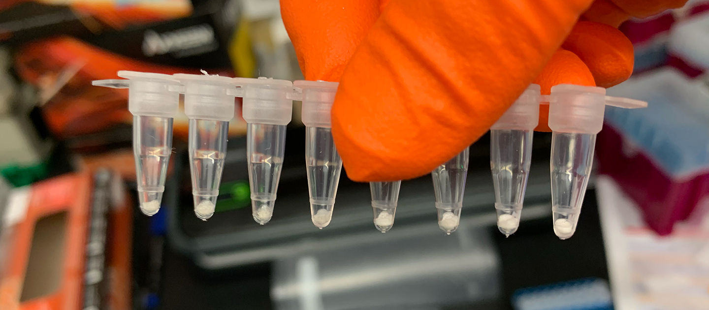 What is a PCR test?