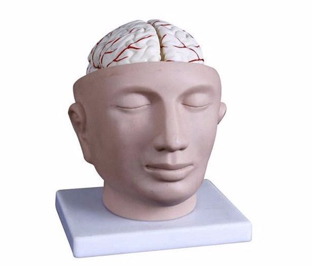 3D printed neurosurgery model to assist surgery plans