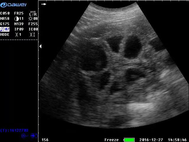 受孕早期母猪的超声临床图像