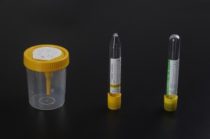 Medicinska enkratno Plastic Vacuum urina Tube Okrogla Bottom 9ml