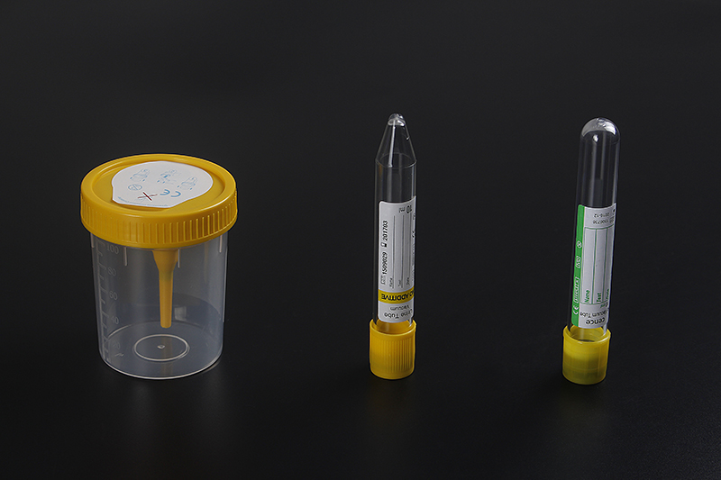 Vacuum urina tubo conico Immagine 10ml inferiore in vetrina