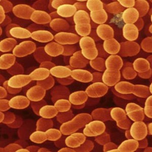 Streptococcus thermophilus 400 billion CFU/g