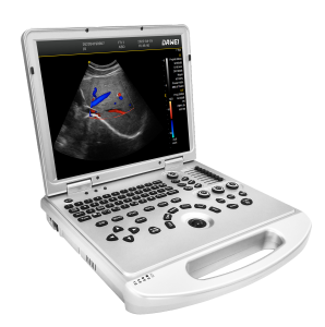 DW-L3 color doppler ultrasound machine