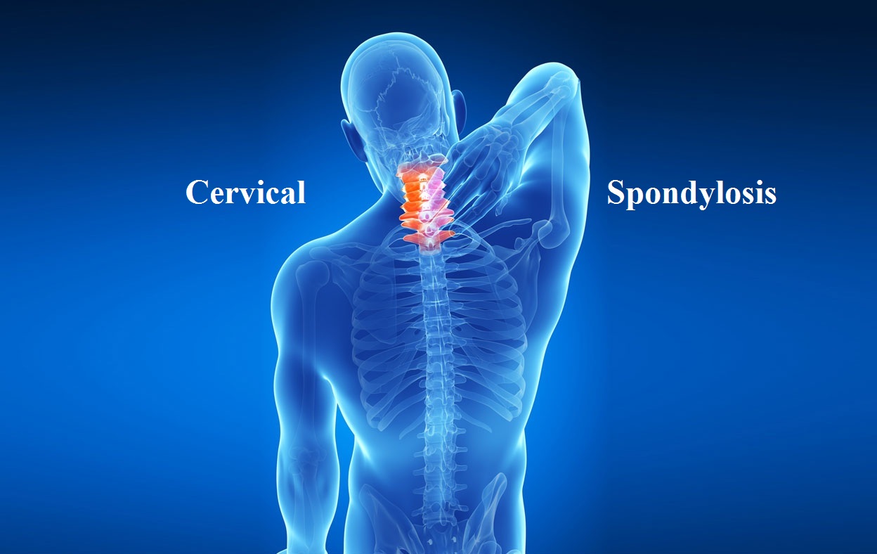 Cervical Spine Rehabilitation
