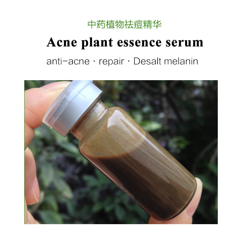 Chinese medicine acne treatment herbal plant essence serum, oem private label Pimple Removal natural face serum for sensitive
